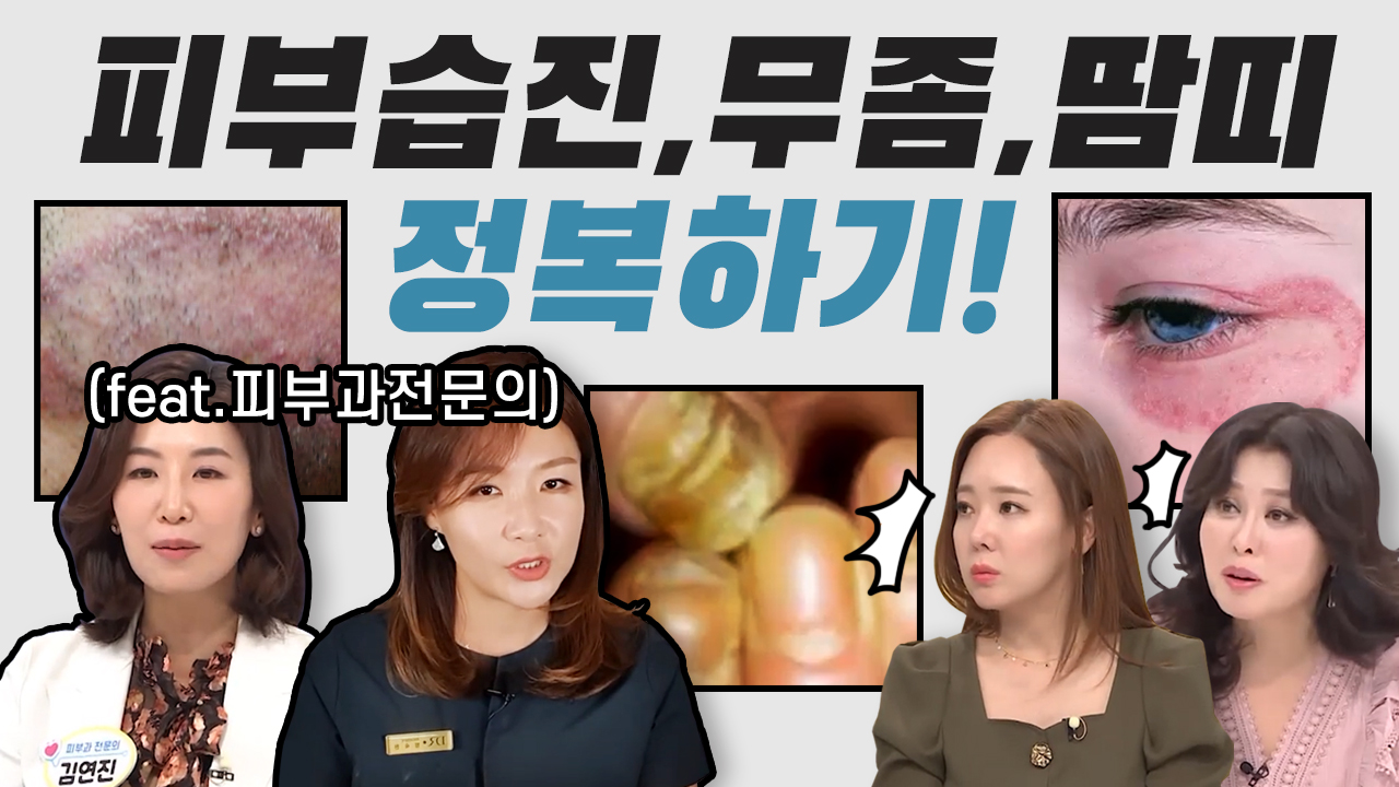 피부 습진, 곰팡이균, 땀띠 정복하기