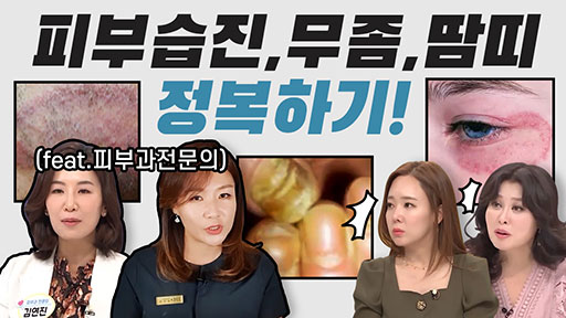 피부 습진, 곰팡이균, 땀띠 정복하기